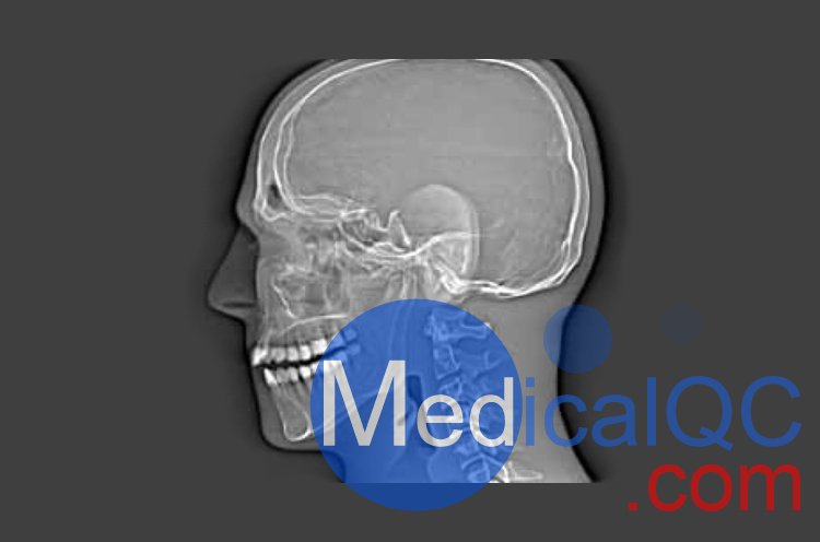 CIRS 711-HN頭部模體，CIRS 711-HN CBCT模體