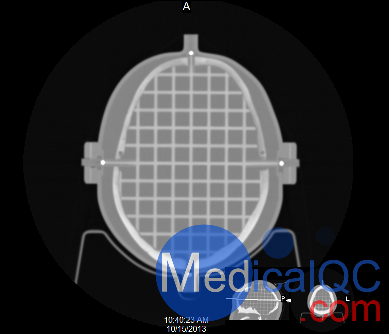 CIRS 603A頭部模體CT圖像