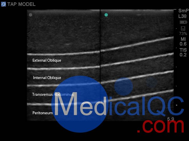 BP2001-TAP腹橫肌超聲訓練模型,BP2001-TAP腹橫肌超聲模體
