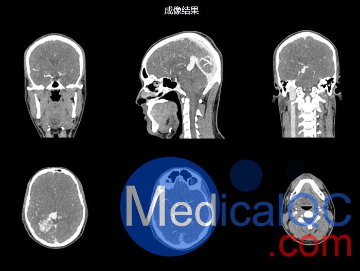 NLP1000頭頸模體，NLP1000頭部模體，NLP1000頭模