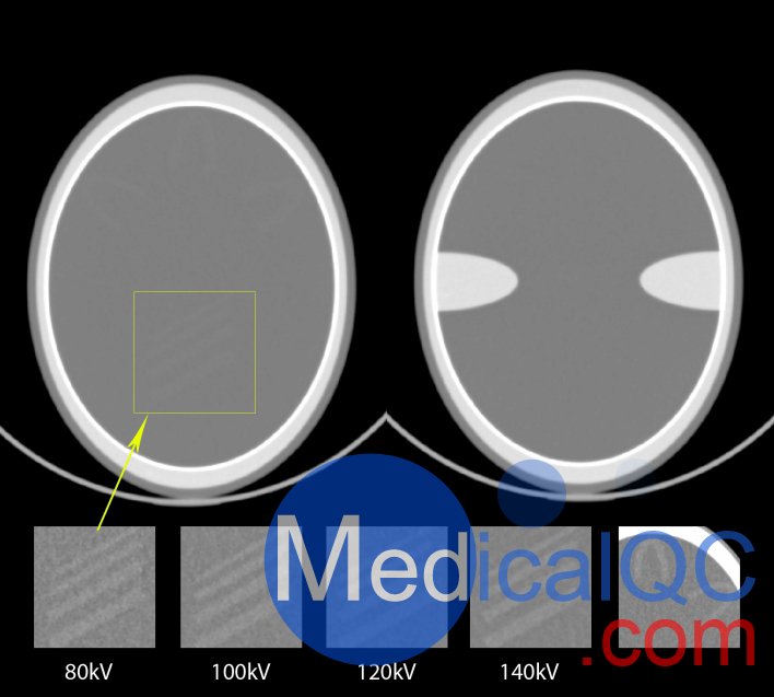 QRM-Cranial-CT-Phantom，顱腦CT模型，Cranial CT Phantom