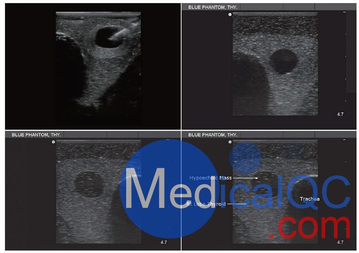 BPT195甲狀腺穿刺模型，BPT195超聲引導(dǎo)穿刺模體影像圖