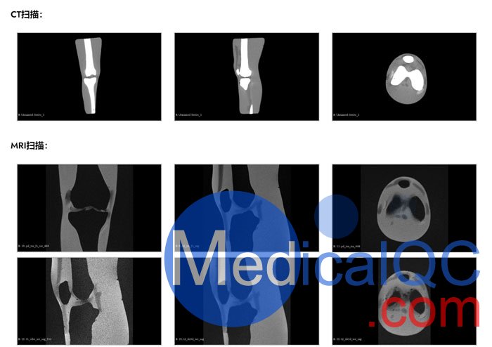 KE-A03成人膝關(guān)節(jié)，KE-A03膝關(guān)節(jié)模體,KE-A03膝關(guān)節(jié)模型成像效果圖