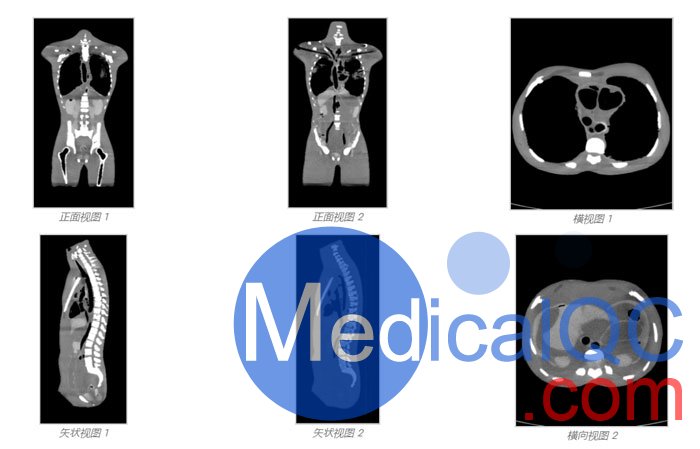 CT-A01成人軀干模體,CT-A01成人軀干模型CT成像效果