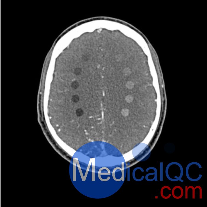 WEK-5005腦血管造影頭模，WEK-5005頭模， CTA AVM頭模成像效果圖