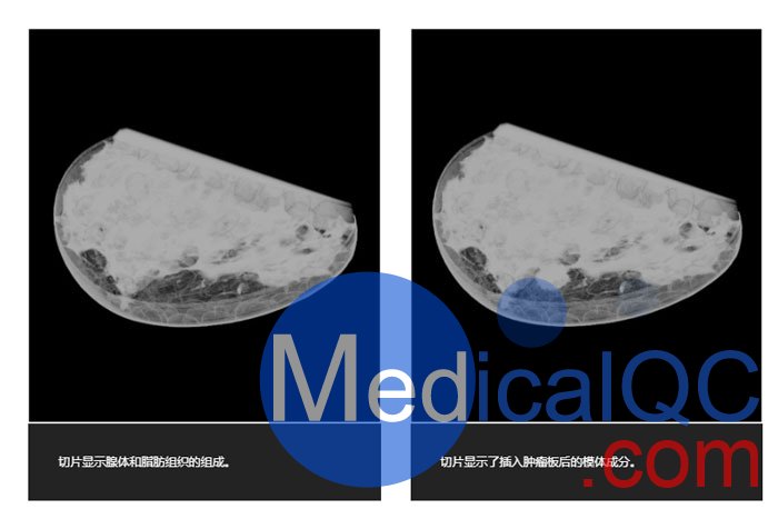 WEK59-01乳腺模體,WEK59-01乳房模型