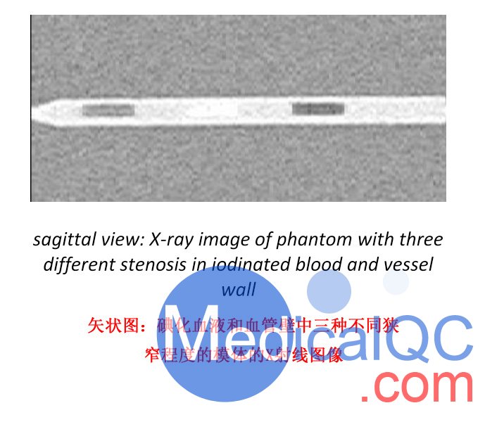 QRM AX冠狀動(dòng)脈狹窄模型,AX冠狀動(dòng)脈模型